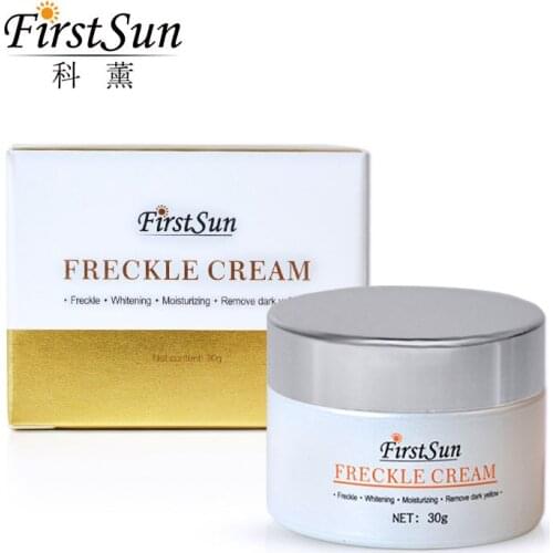 Strong Freckle Whitening Cream Fade Speckle Melasma Pigment Melanin Sunburn Acne Brown Spots Corrector Skin Serum Face Care 30g