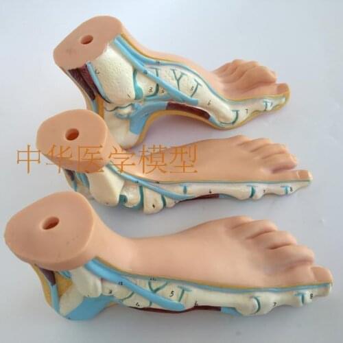 Foot Anatomical Model Flat Foot Arcuate Foot Three-piece Foot Anatomy Model pesplanus pes arcuatus feet