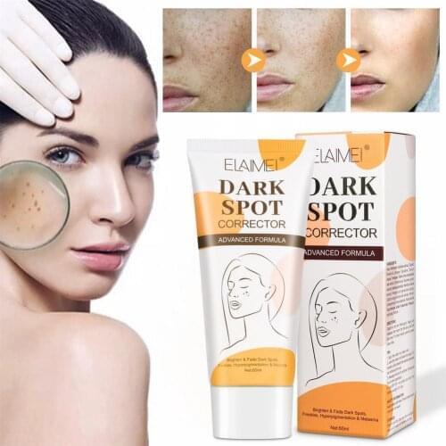 80g Dark Spot Corrector Brighten Fade Dark Spots Freckles Cream Effective Whitening Cream Remove Freckle