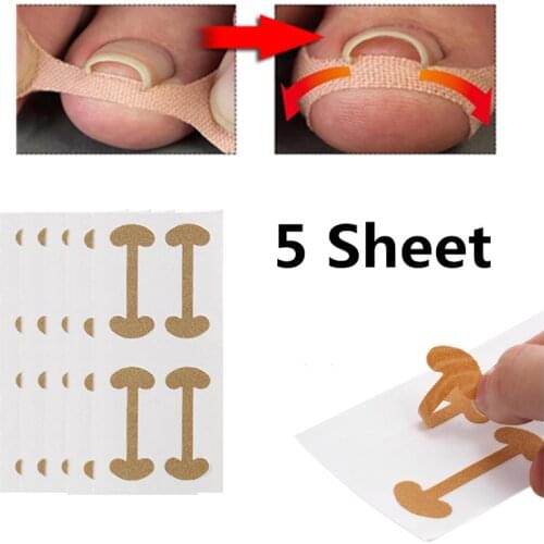 5 Sheet/20Pcs Embedded Toe Nail Corrector Stickers Ingrown Toenail Corrector Treatment Toenail Sticker Foot Care Tool