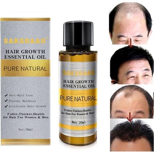 Hair Care Hair Growth Essential Oils Essence Original Authentic 100% Hair Loss Liquid Health Care Beauty Dense Hair Growth Serum