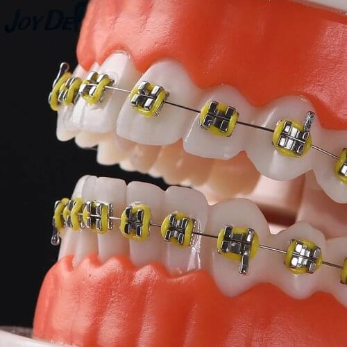 Tandheelkundige Orthodontische Tanden Model Met Metalen Beugels Bretels School Onderwijs Apparatuur New