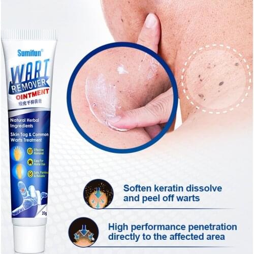 2021 Hot Herbal Extract Wart Remover Ointment Wart Treatment Skin Mark Remover Cream Antibacterial Foot Wart Ointment SSwell
