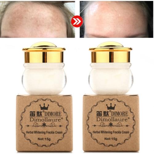 Dimollaure Retinol whitening Freckle cream removal speckle age spots melasma sunburn acne scar removal dark spot skin whitening