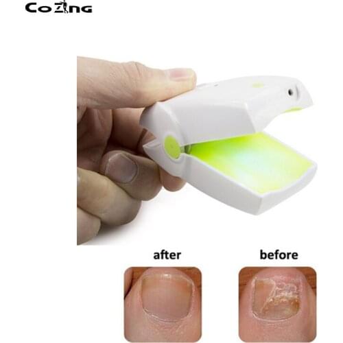 Nail Treatment Device Onychomycosis Therapy Apparatus Laser Light Therapy Device