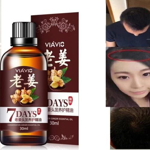 Hot 30ml Magic Fast Hair Growth Dense Regrowth Ginger Serum Oil Anti Loss Treatment Essence Bin Wild Hair Growth Tools Hair Care