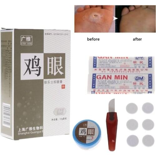 1Pcs Foot Care Sticker Medical Patch Corn Removal Pads Warts Thorn Curative Patches Calluses Remove Callosity Detox