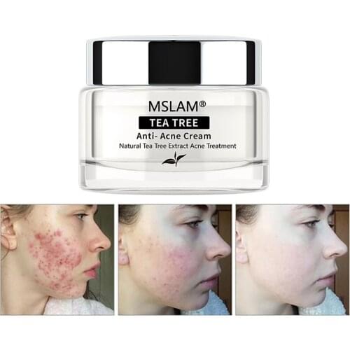 Tea Tree Face Cream Anti-Acne Shrink Pores Repair Gel Oil Control Nourish Whitening Acne Scar Remove Acne Treatment Skin Care