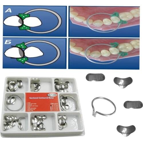 100Pcs Each Box Dental Matrix Sectional Contoured Metal Matrices No.1.398 lmws