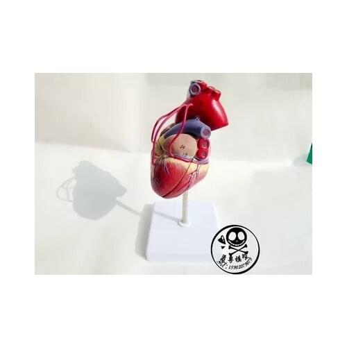Human Pathological heart Arteries 1:1 Human heart model free shipping