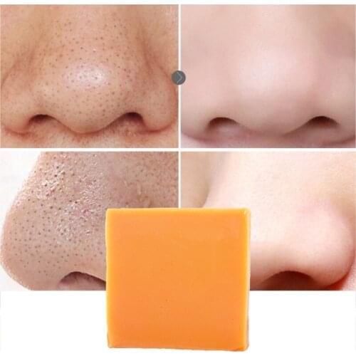 100g Ginger Essential Oil Soap Hair Shampoo Deep Cleansing Acne Treatment Oil-control Whitening Body Face Skin Care Soap