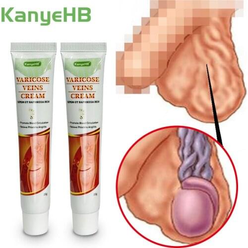 2pcs Varicocele Cream Scrotum Varicose Vein Treatment Cream Testis Varicosity Removing Plaster Leg Varicose Herbal Ointment A640