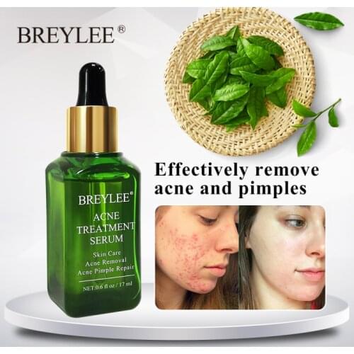 1Pc 17ml Green Tea Serum Acne Repair Serum Facial Anti Acne Scar Removal Skin Care Pimple Remover Repair Serum Liquid TSLM1