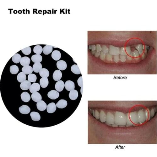 Temporary Tooth Repair Kit Teeth Whitening Teeth Filling Materials Fix Teeth Teeth And Gaps FalseTeeth Solid Glue Beauty Tool