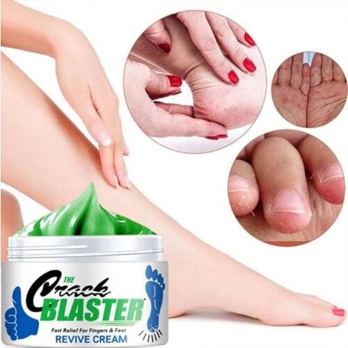 Cracked Hands And Feet Cream 1pc Scars Foot Cream Ointment Moisturizing And Anti-dry Foot Care Cream 15g/30g/50g