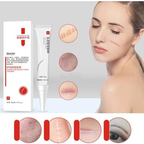 Scar Removal Cream Acne Scars Gel Stretch Marks Surgical Scar Burn For Body Pigmentation Corrector Acne Spots Repair Care