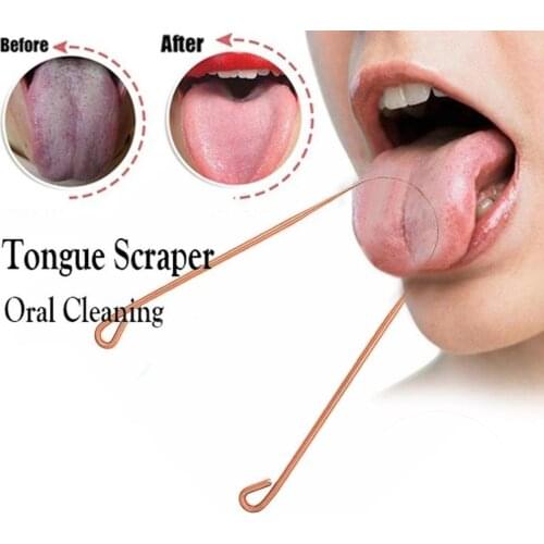 Eliminate Bad Breath Tongue Cleaner Two Colors Metal Tongue Scraper Oral Care Tool Brush Cleaning Remove Stain To Fresher Breath