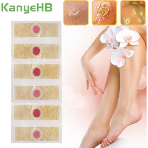 30pcs Callus Patches Foot Care Plaster Medical Foot Corns Patches Warts Thorn Stickers Health Care Foot Corn Removal Pads A175
