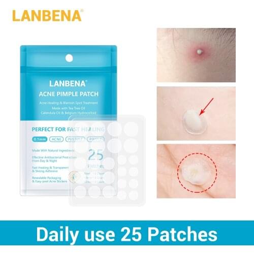 LANBENA Acne Pimple Patch 25pcs Daily Use Blemish Treatment Invisible Acne Stickers Acne Master Face Mask Beauty Tool Skin Care