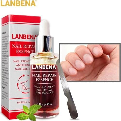 LANBENA Nail Repair Essence Serum Fungus Removal Nails Gel Anti Infection Paronychia Onychomycosis Hand Foot Nails Care 3Pcs/Set