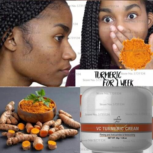 Golden Turmeric Face Cream Moisturizer Whitening Repair Acnes Scar Dark Spot Lightening Skin Cream KR(Origin)