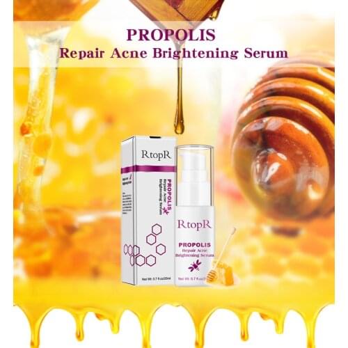 RtopR Propolis Repair Acne Brightening Serum Acne Scar Spots Cleaning Serum Shrink Pores Eliminates Acne Treatment Oil control
