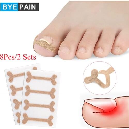 8Pcs/2Sets Toenail Correction Patch Ingrown Toenails Band Aid Relief Pain Paronychia Correction Pedicure Elastic Force Sticker