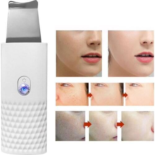 50% Hot Sale Electric Ultrasonic Blackhead Remover Facial Beauty Device Pore Cleasning Tool
