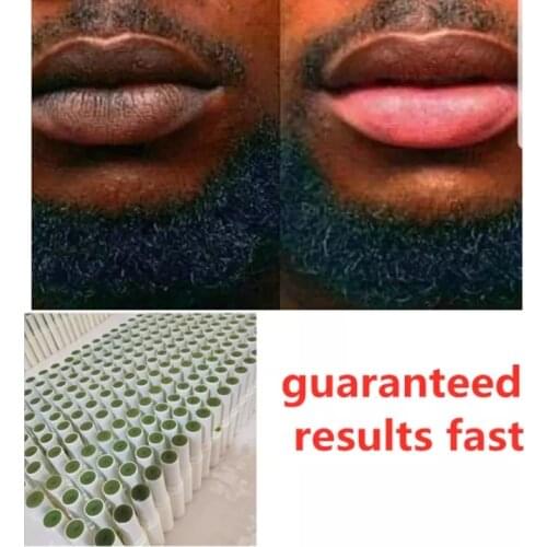 100% Handmade Lips Pink Fresh Lightening Bleaching Balm Lip Treatment Remove Dark Smoke Lips