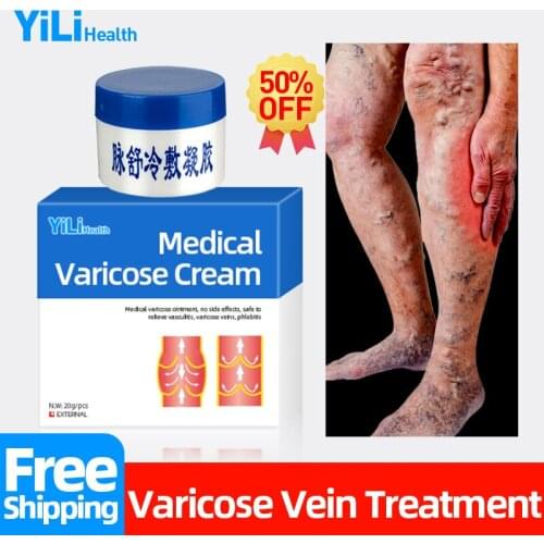 Varicose Veins Cream Treatment Varicosity Angiitis Vasculitis Inflammation Phlebitis Spider Legs Pain Relief Medicine Ointment