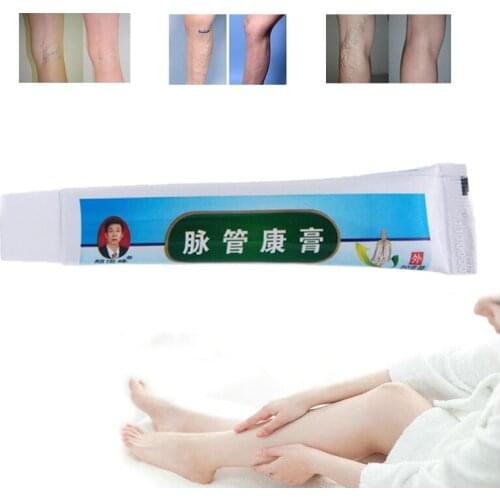 No box 5PCS/LOT Chinese Herbal Medicine Plaster Cream for treating varicose vascular inflammation cream varicose vein ointment
