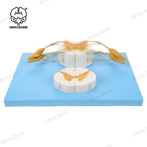 Enlarged Spinal Cord Model,5X Life Size Nerves Plus Anterior and Posterior Nerve Roots and Spinal Ganglion