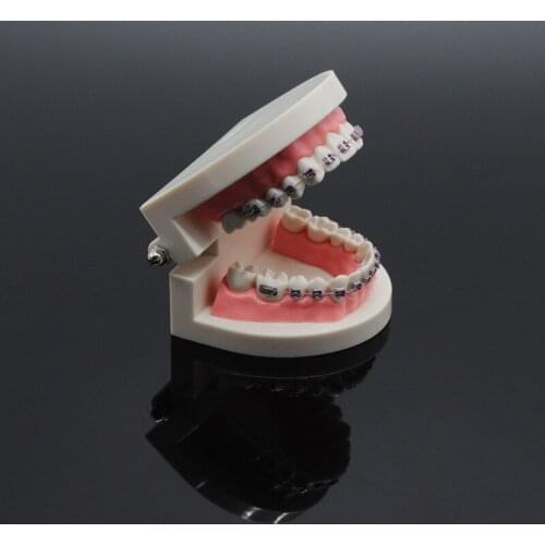 Dental Teach Study Standard Typodont Demonstration Teeth Model With Bracket For Dentistry Lab