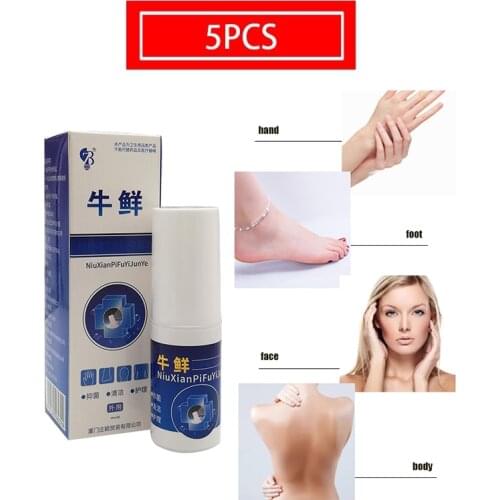 5pcs Absolutely Genuine Skin Psoriasi Spray Strong Effective Treatment Psoriasis Dermatitis Eczematoid Eczema skin Spray