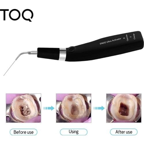 Dental sonic irrigator dentistry endo file sonic activator for root canal instrument tips ULTRA X Ultrasonic activator tool