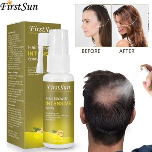 Hair Care Essential Oil Essence Preventing Hair Loss Moisturizing Nourishing for Women Men MPwell