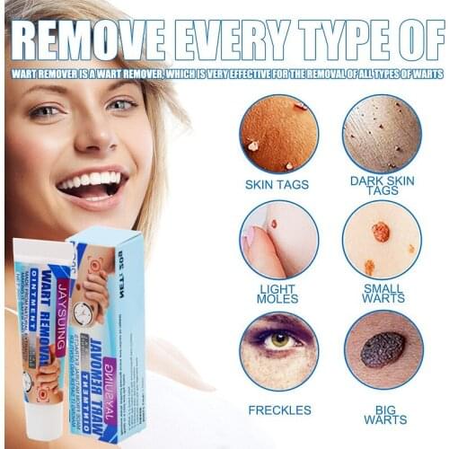 Wart-removing Cream To Repair Ordinary Yukes Body, Face and Neck Skin Whitening Skin Care Products Skin Whitening Products