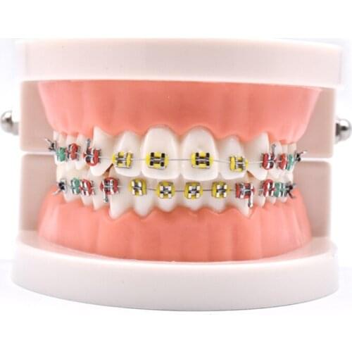 Dental Orthodontic Treatment Teeth Model With Bracket Arch Wire Buccal Tube Ligature Ties Dentist Lab Tooth Model