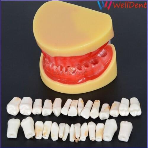 Dental Learning Teeth Model All Teeth Removable Standard Teeth Tooth Model 28 Pcs Teeth Student