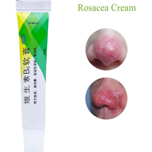 Herbal Medicine Rosacea Cream Treatment Red Nose Acne Mites Rosacea Cream Remove Skin Redness Flushing Vaseline Face Bleaching