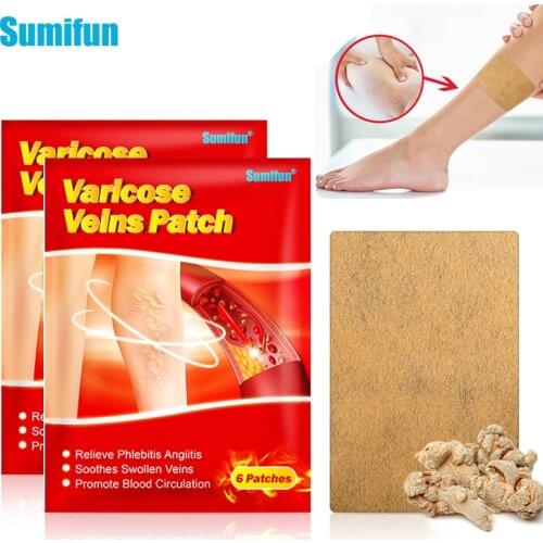 12/24 pcs Sumifun Varicose Veins Treatment Angiitis Plaster Vasculitis Swelling Patch Phlebitis Spider Leg Herb Medical Plaster