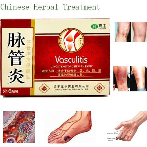 24PCS Spider Veins Varicose Treatment Plaster Varicose Veins Cure Patch Vasculitis Natural Solution Herbal Patches