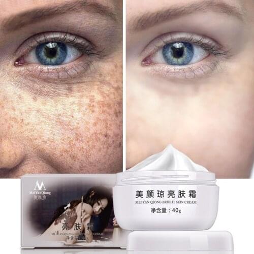 40g Powerful Whitening Freckle Cream Strong Effects Remove Melasma Acne Spots Pigment Whitening Moisturizing Face Cream