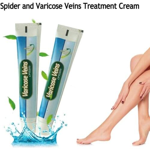 Chinese Varicose Veins Cream Ointment Vasculitis Treatment Phlebitis Angiitis Inflammation Blood Vessel Legs Ointment