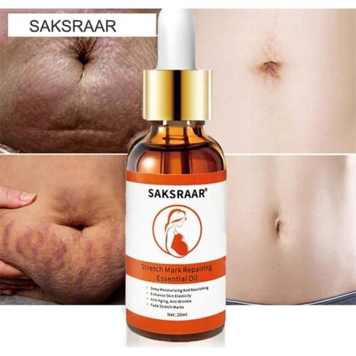 Remove Pregnancy Scars Essential Oil Stretch Mark Treatment Maternity Repair Anti-Aging Anti-Winkle Firming Body Skin Care