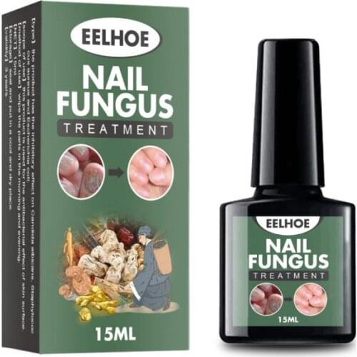 15ml Nail Repair Oil Care for Discoloration Nail Loss Product for Manicure Promote Healthy Nail Growth Nails Care Liquid TSLM1