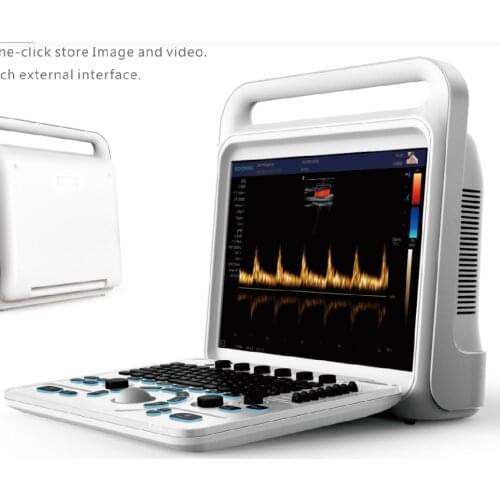 Abdomen, gynecology ECHO 60 full digital color Doppler System ultrasound machine and usg doppler system with humanized design