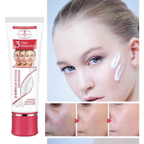 Vitamin E Whitening Face Cream Remove Melasma Spot Pigment Melanin Dark Spots Pigmentation Wrinkle Moisturizer Nourish Skin Care