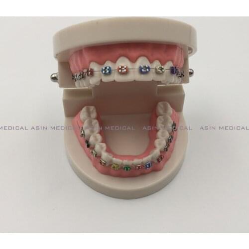 Orthodontics Model for Dentist Dental 1/2 Standard Dentition with Full Metal Brackets Teeth Model