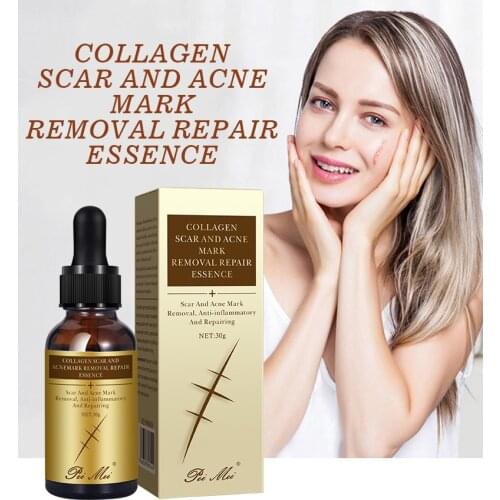 New Acne Scar Removal Cream Treatment Stretch Marks Skin Repair Smoothing Whitening Moisturize Body Scar Skin Care Products 30g